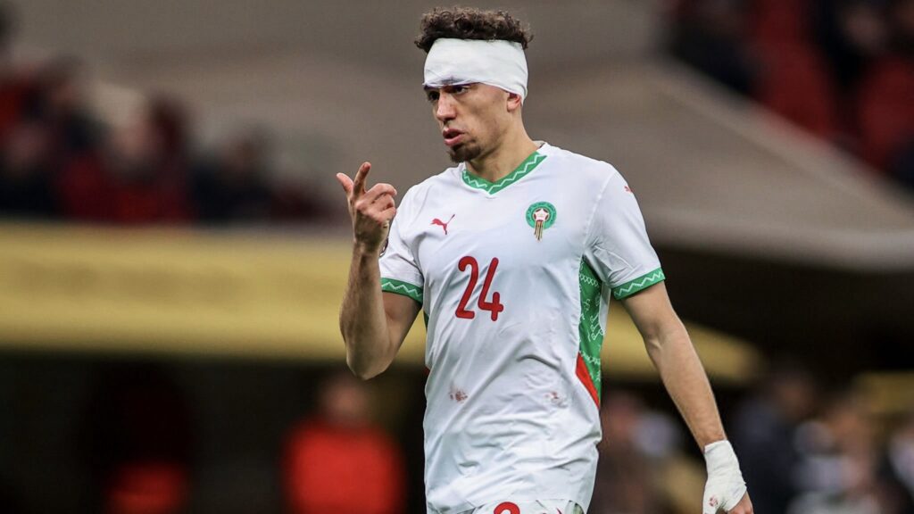 إصابات لاعبي المنتخب المغربي بعد كأس إفريقيا تضع الأندية أمام تحديات كبرى